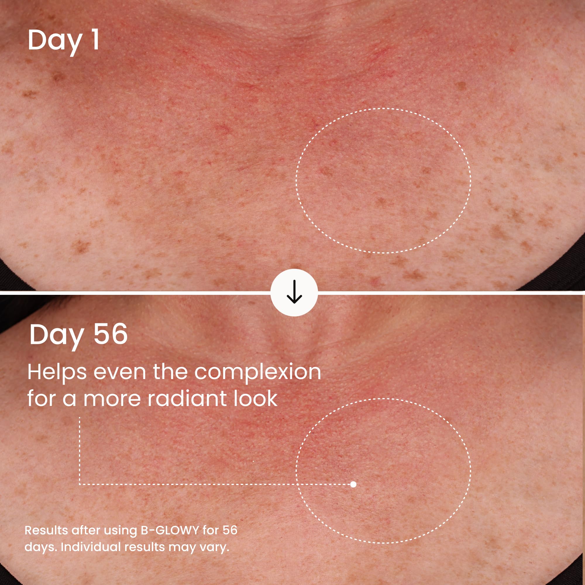 MAËLYS B-GLOWY Brightening Body Serum for Dark Spots - Supports Even Looking Skin - Peptide Formula with Niacinamide & Meadowfoam Oil (3.4 Fl Oz) - Image 4