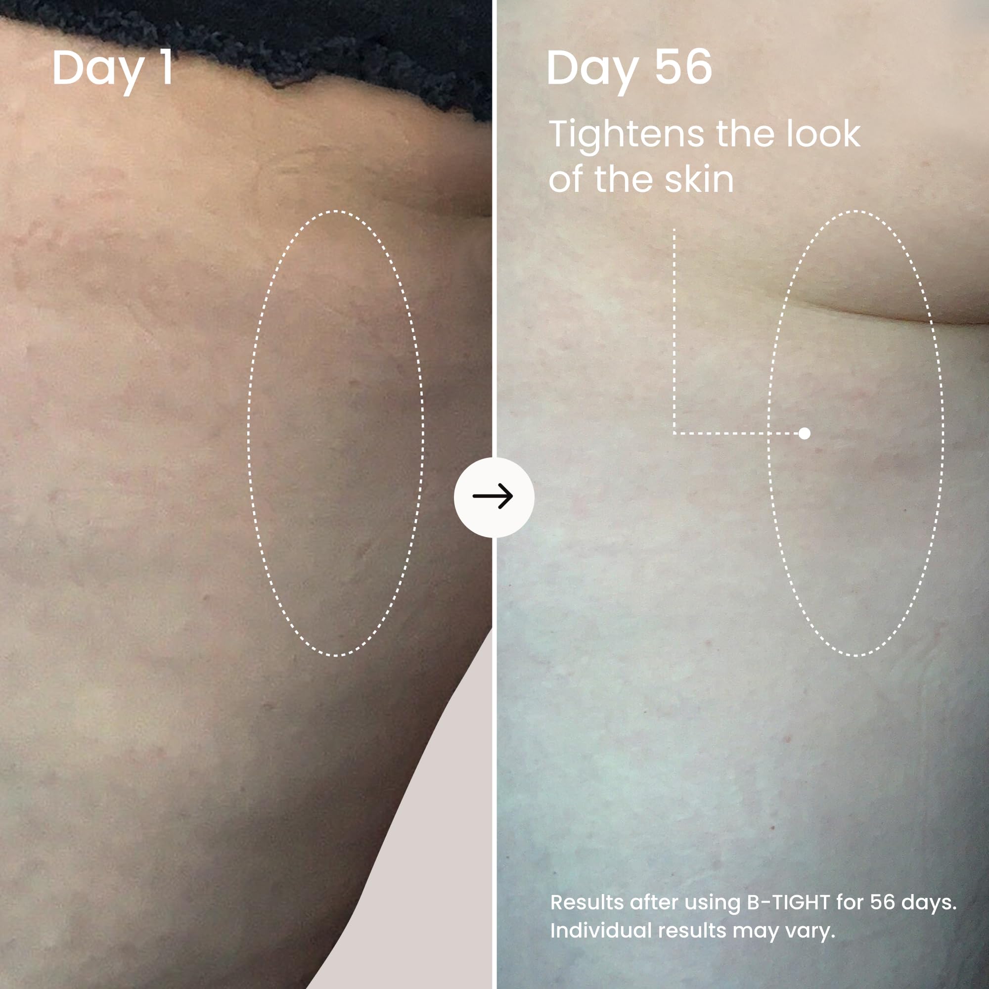 MAËLYS B-TIGHT Lift & Firm Booty Mask - Skin Tightening & Firming Cream for Booty & Thighs - Cellulite Cream with Caffeine & Brazilian Peppertree - Butt Mask for Smooth-Looking Skin (3 Pack) - Image 4