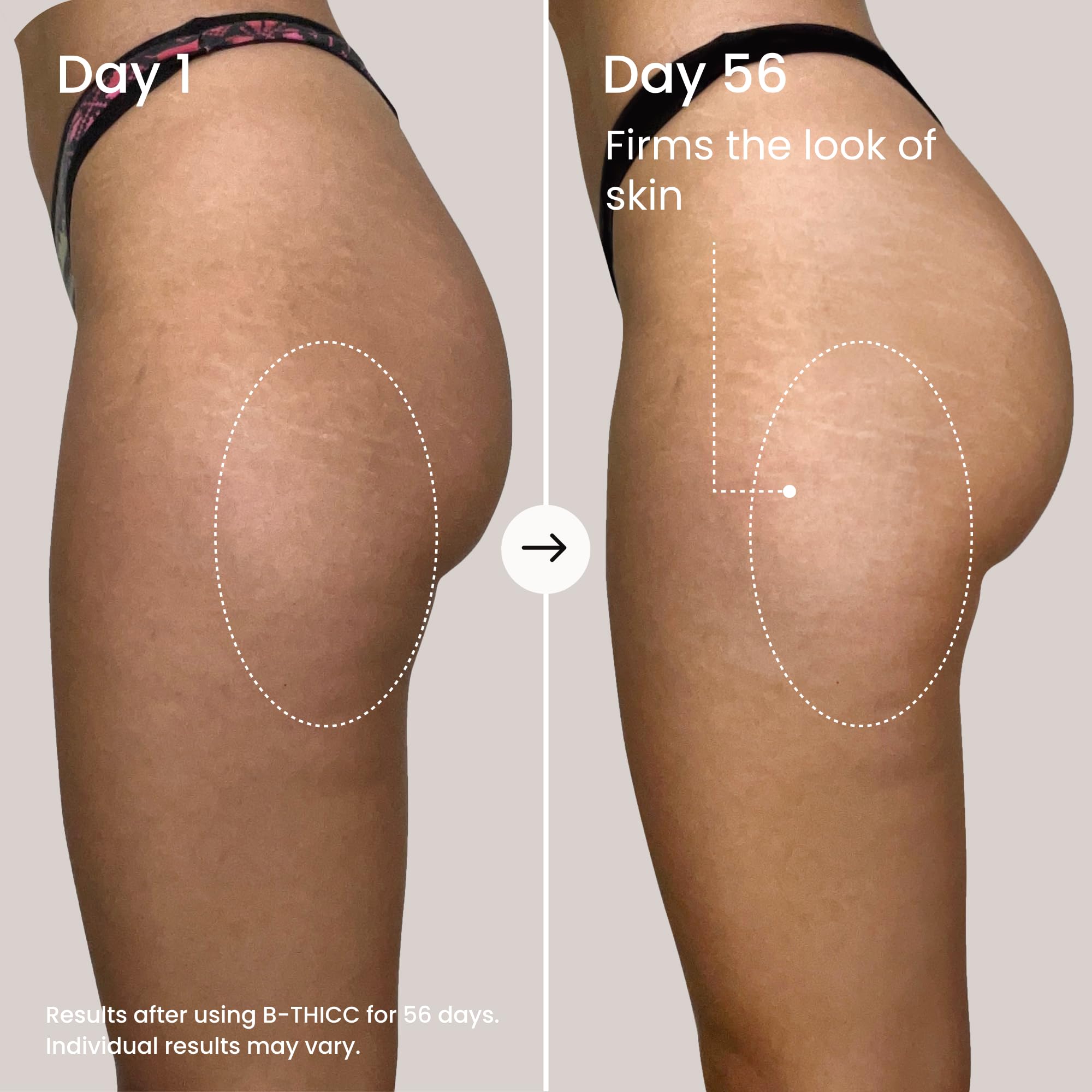 MAËLYS Full Body Reshaping Bundle - B-TIGHT Lift & Firm Booty Mask - B-THICC Booty Enhancing Mask - B-FLEX Firming Arm Cream - B-FLAT Belly Firming Body Cream - B-FOXY Inner Thigh Firming Cream - Image 7