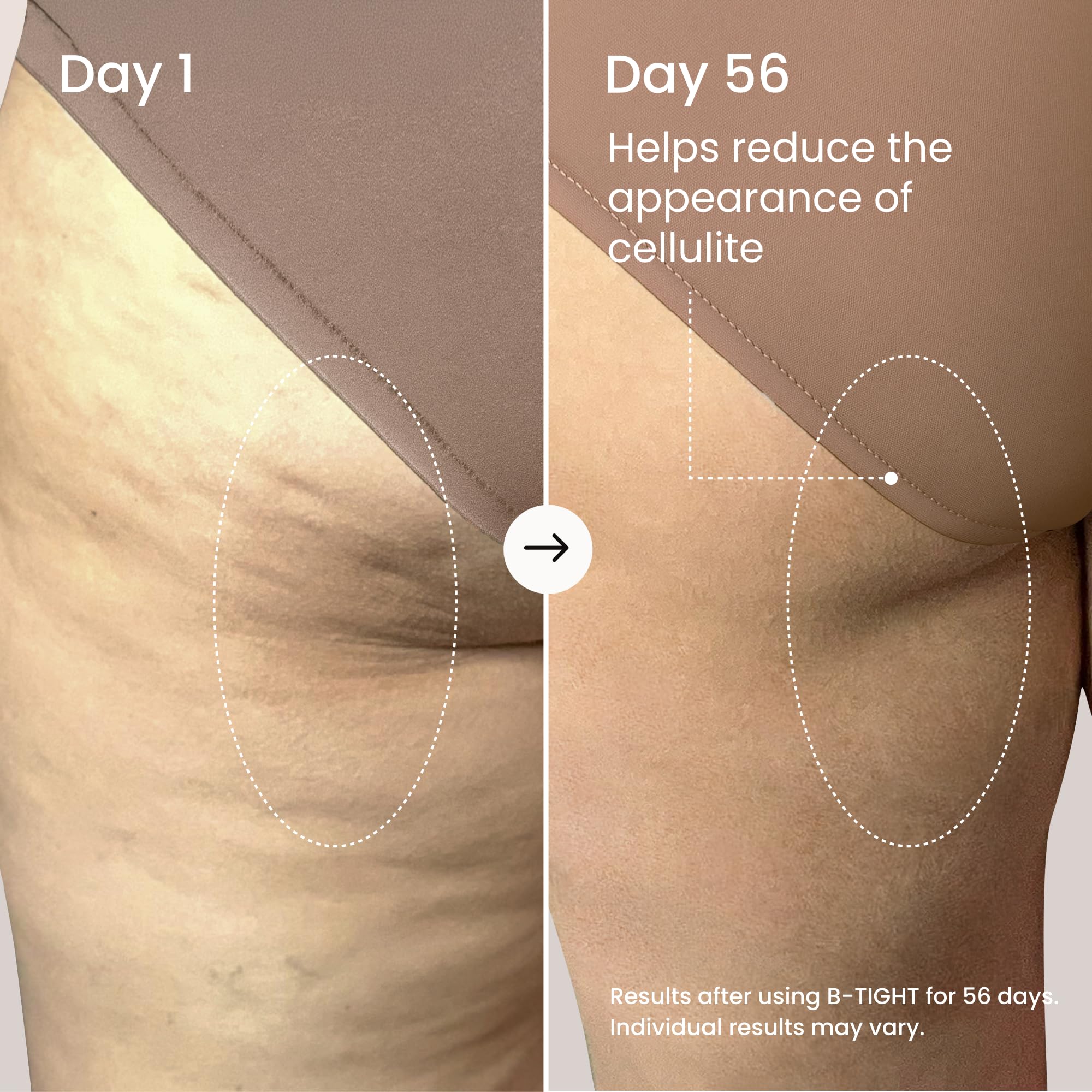 MAËLYS Body Firming Bundle - B-TIGHT Lift & Firm Booty Mask - B-FLAT Belly Firming Body Cream - B-PERKY Lift & Firm Boob Mask - Body Care Set - Image 6