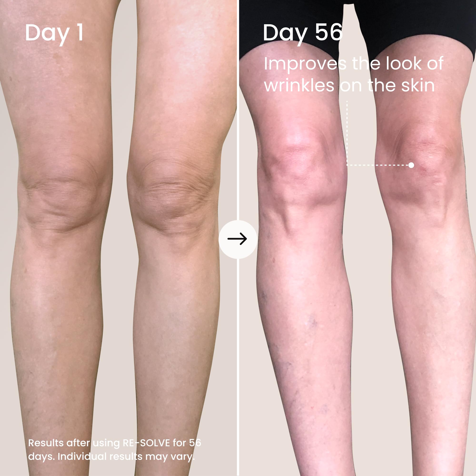 MAËLYS RE-SOLVE Age-Defying Body Serum - Hydrating Body Serum for Crepey Skin with Hyaluronic Acid - Visibly Smooths Aging Skin (3.5 Fl Oz) - Image 3