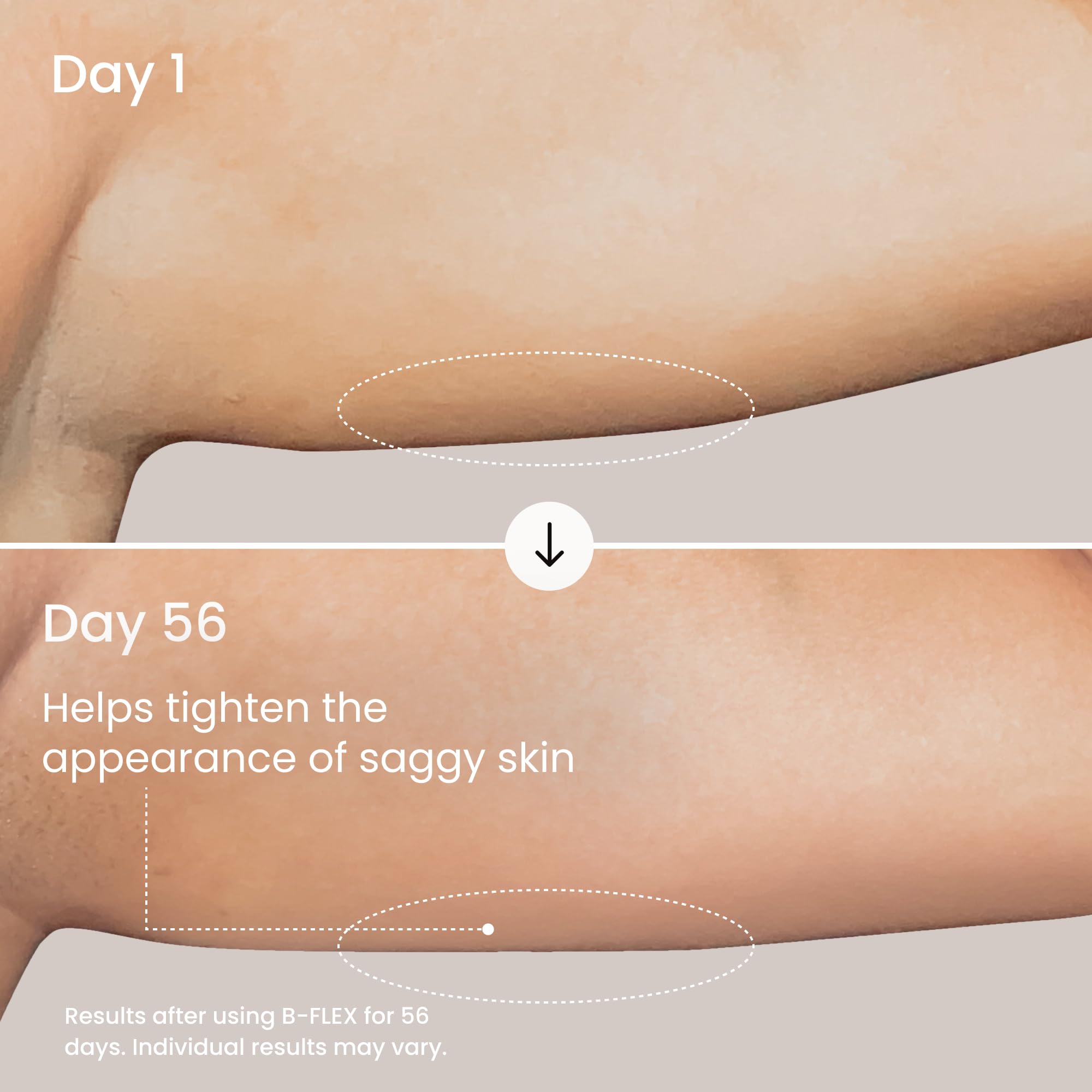 MAËLYS Arm & Booty Tightening Duo - B-TIGHT Lift & Firm Booty Mask - B-FLEX Firming Arm Cream - Body Care Set - Image 7