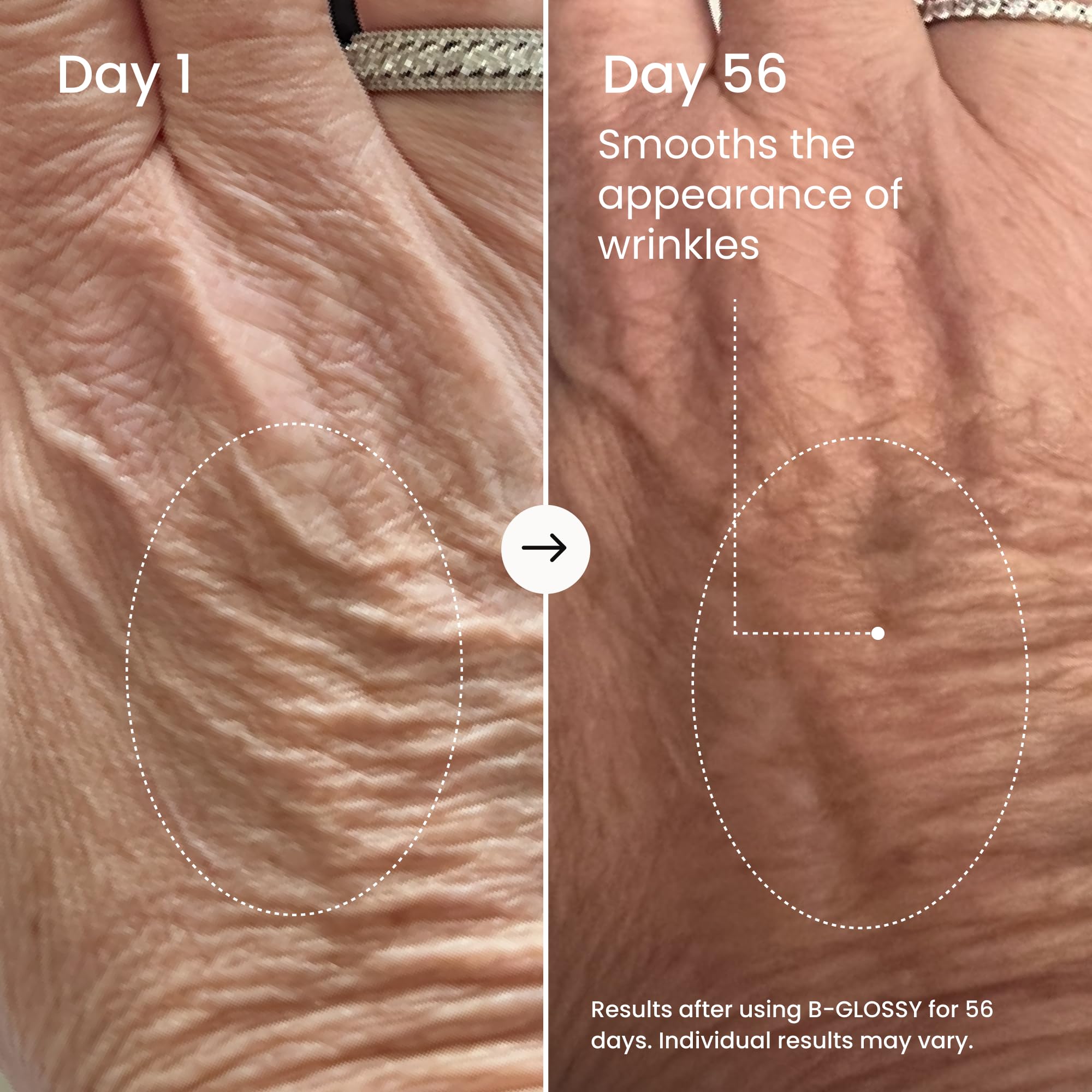 MAËLYS Smooth & Radiant Body Duo - B-GLOWY Brightening Body Serum - B-GLOSSY Smoothing Body Serum - Body Care Set - Image 3