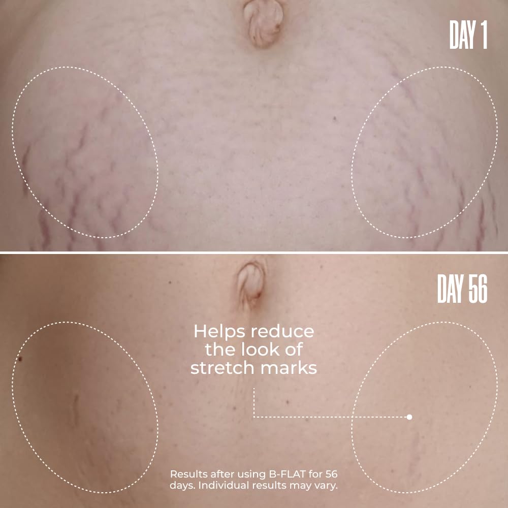 MAËLYS THE BELLY & BUM DUO - Image 3