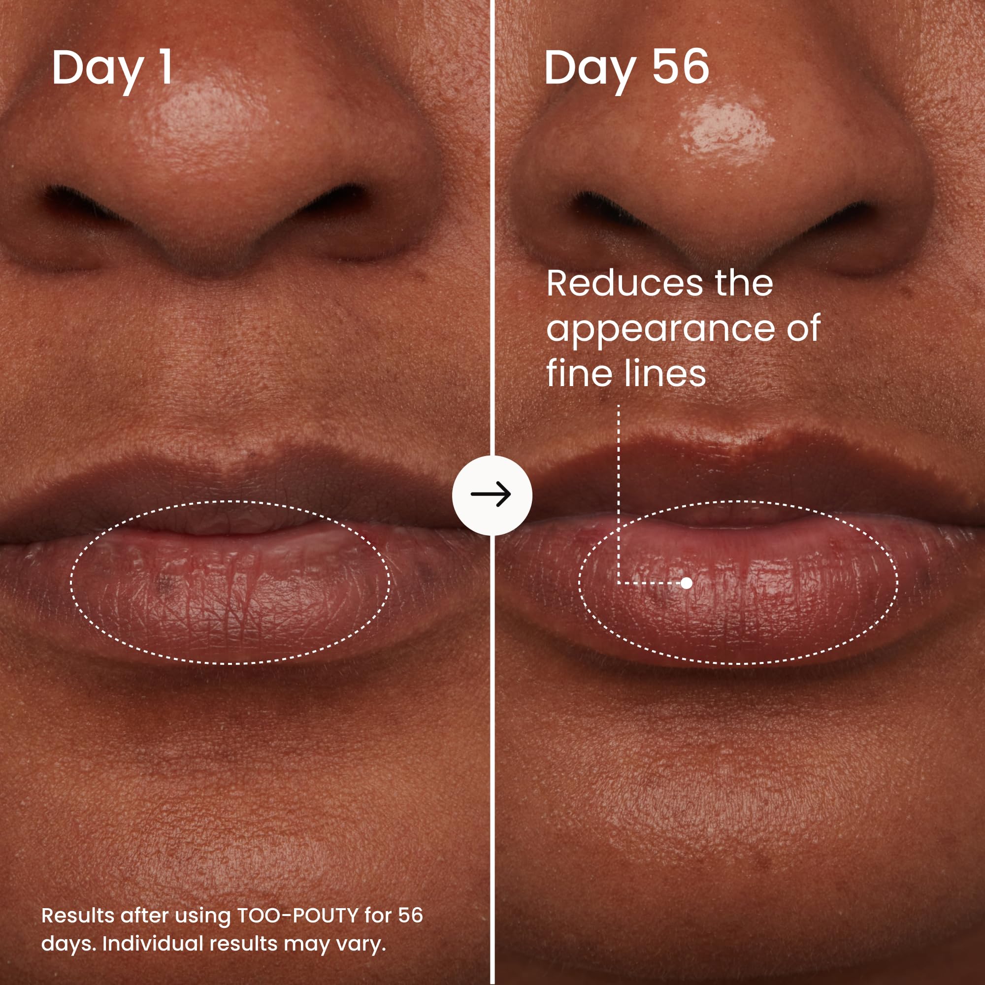 MAËLYS TOO-POUTY Lip Plumping Mask - Dual-Use Lip Treatment and Primer - Visibly Smooths Fine Lines and Enhances Fullness (0.5 Fl Oz) - Image 4